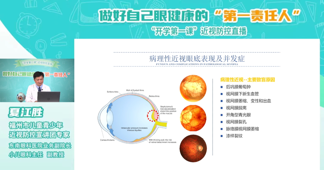 福州科技馆眼健康分馆开展做好自己眼健康的“第一责任人”开学第一课近视防控直播